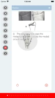 Bone Age iphone resimleri 3