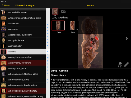 Screenshot #5 pour Images Of Disease