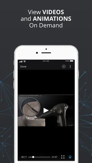 The Arthrex Surgeon App screenshot 4