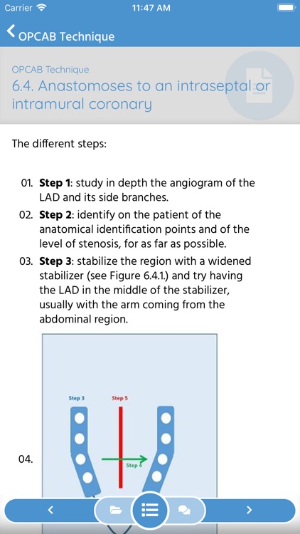 CABG - OPCAB Surgery Training screenshot-4
