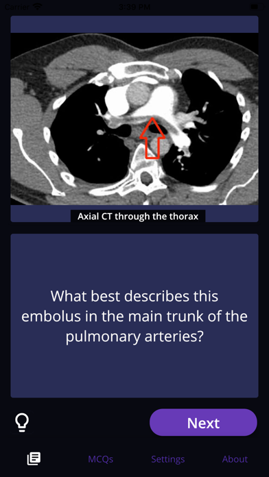 Screenshot #2 pour Basic Radiology