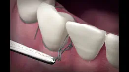 the oral surgery suture trainer iphone capturas de pantalla 3