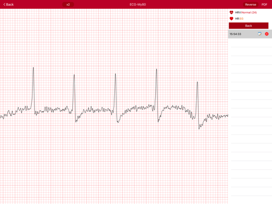 Screenshot #5 pour imedtrack