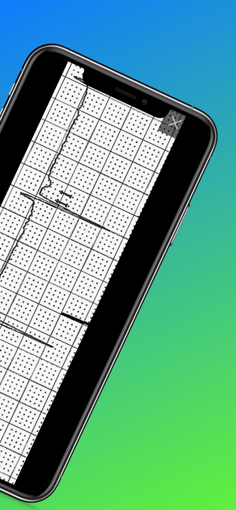ECG Challenge - Medical App | MWM