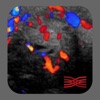 TI-RADS Calc icon