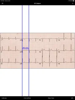 EP Calipers iPad image 1