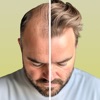 AI Hair Loss Scanner: HairCode icon