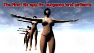 Breasts & Butts Implants AR iphone resimleri 1