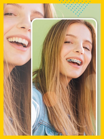 Braces on teeth – stickers ai iPad screenshot
