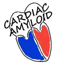 Cardiac Amyloidosis