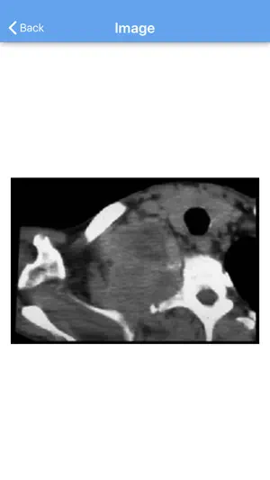 CT Surg IX screenshot 4