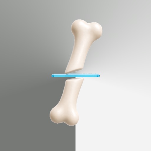 OsteotomyMR
