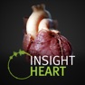 Get INSIGHT HEART for iOS, iPhone, iPad Aso Report