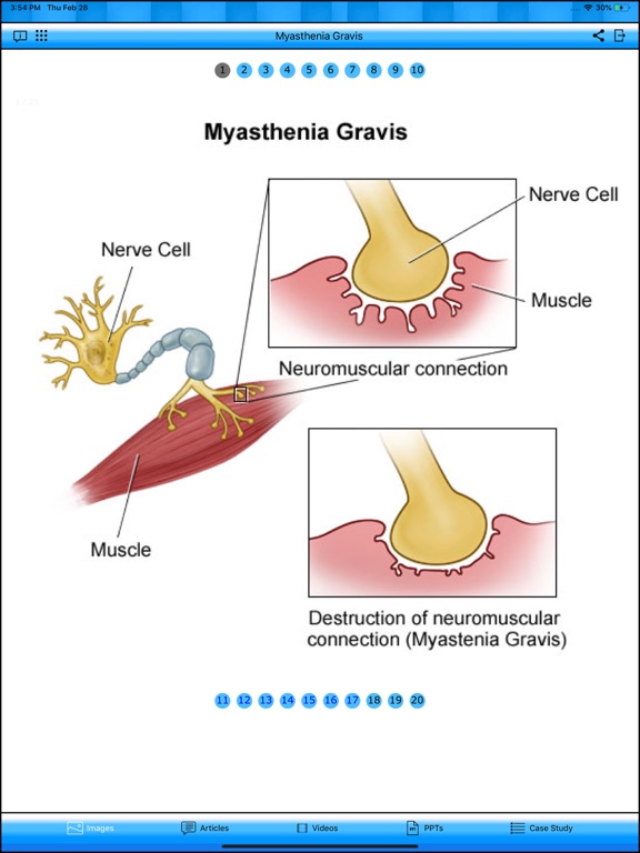 Myasthenia Gravis iPad screenshot