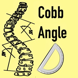 CobbAngleApp