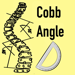 CobbAngleApp