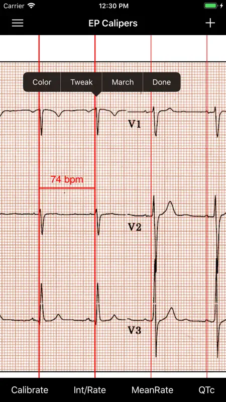 EP Calipers screenshot 3 of 7