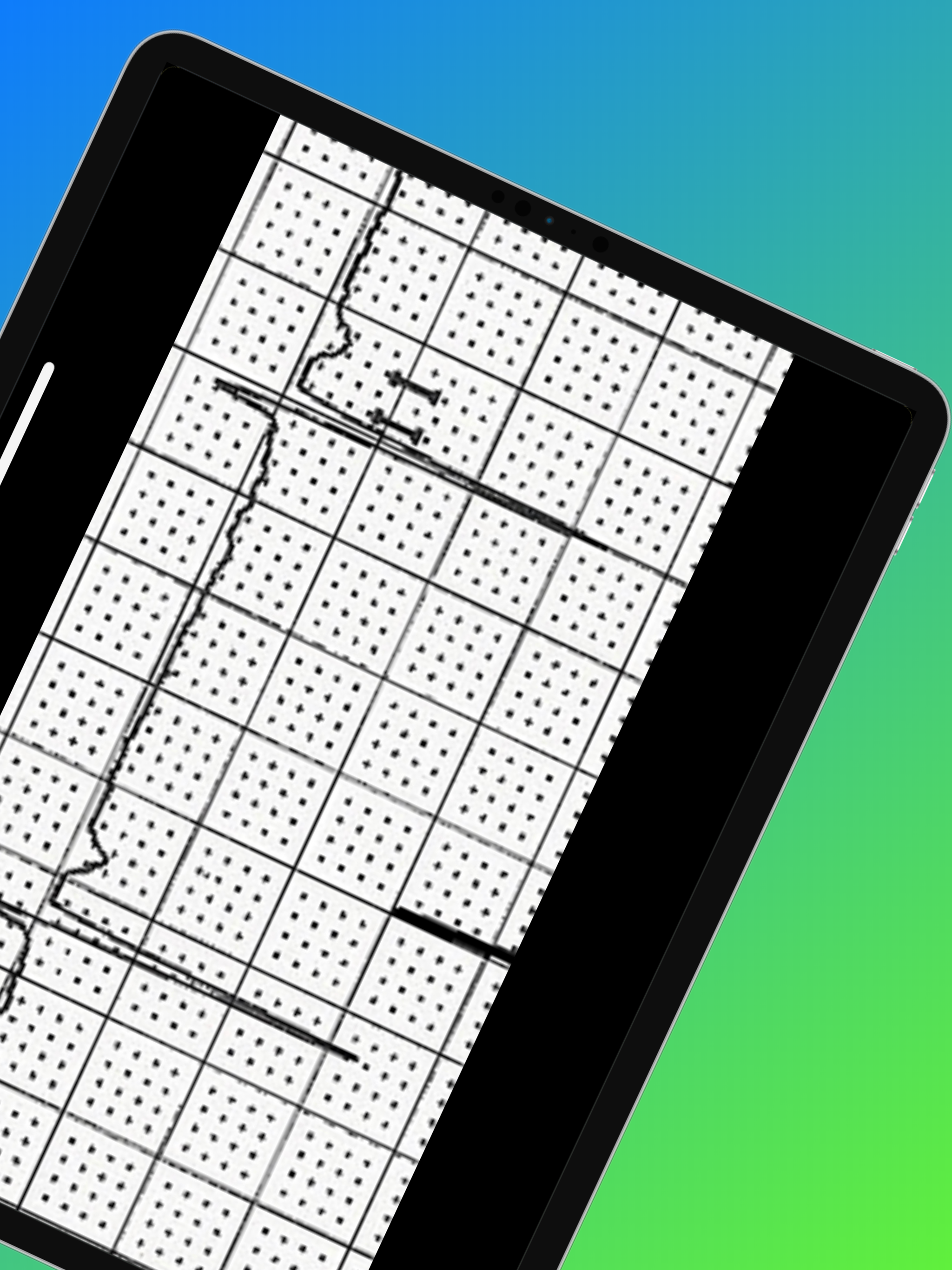 ECG Challenge screenshot 13