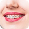 AI Braces Camera Photo Editor icon