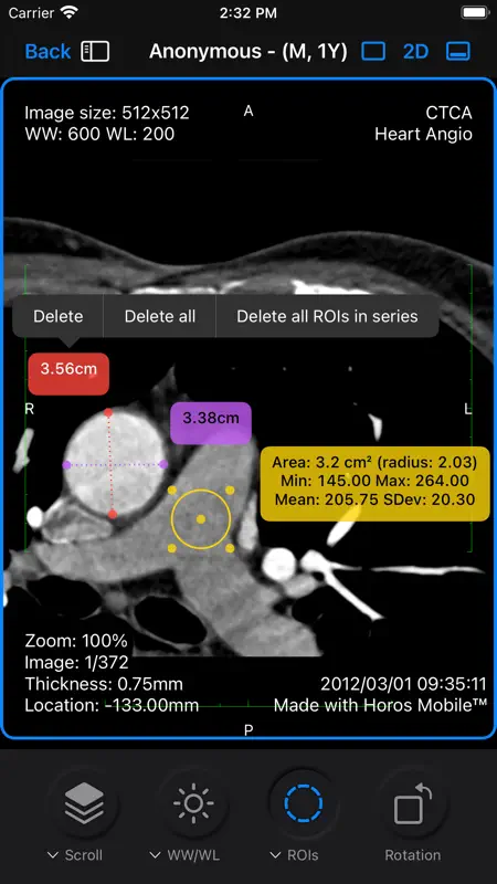 Falcon Mx - DICOM Viewer screenshot 8 of 10
