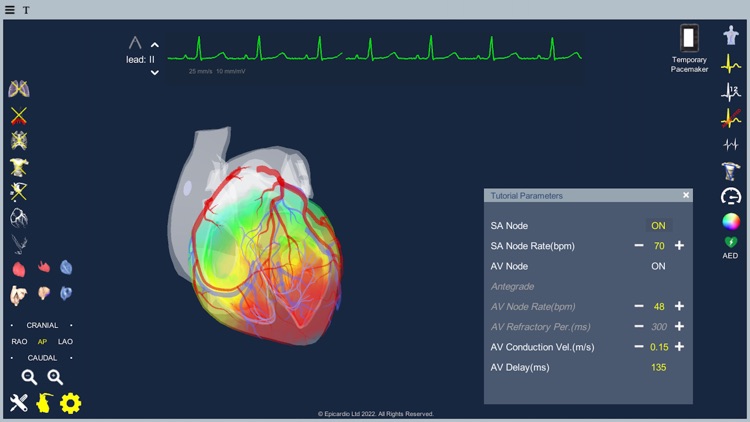 Epicardio Heart Simulator screenshot-4