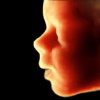 ScanBaby ultrassom do bebê - Scanbooster