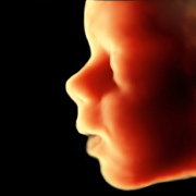 ScanBaby ultrasonido bebe