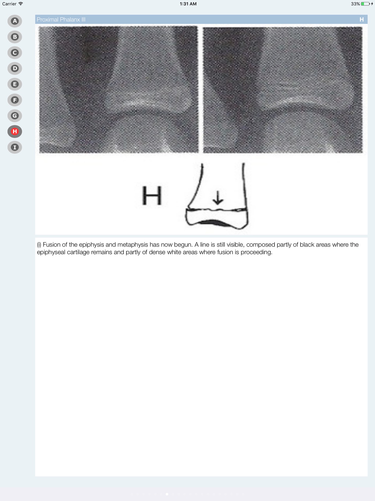 Screenshot 7 of Bone Age