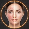 Beauty Editor: Acne Remover icon