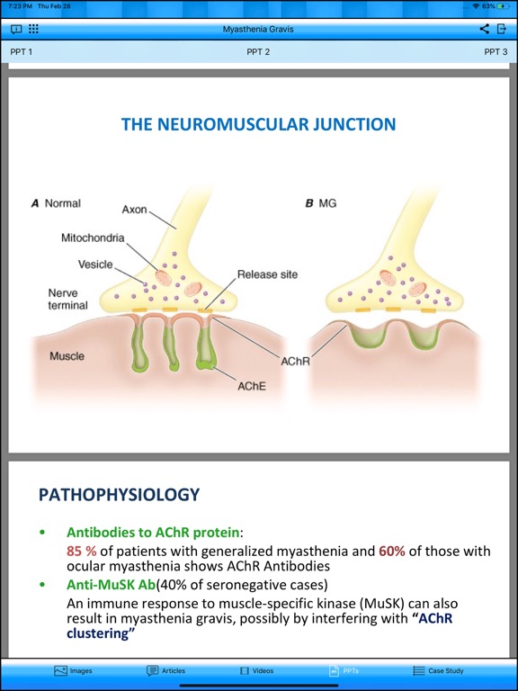 Myasthenia Gravis iPad screenshot