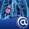 Non-Small Cell Lung Cancer icon