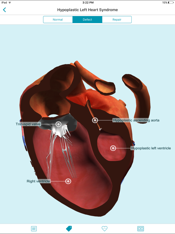 Heartpedia iPad screenshot 7 - Medical app