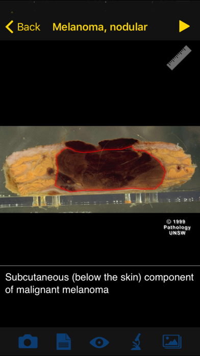 Images Of Disease screenshot