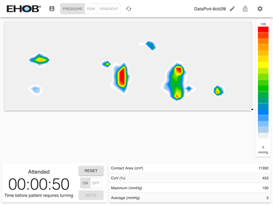 Screenshot #5 pour EHOB Bed Monitor