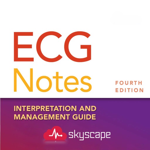 ECG Notes: Quick look-up ref.