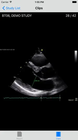 VidistarViewer screenshot 1
