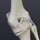 Knee Biomechanics