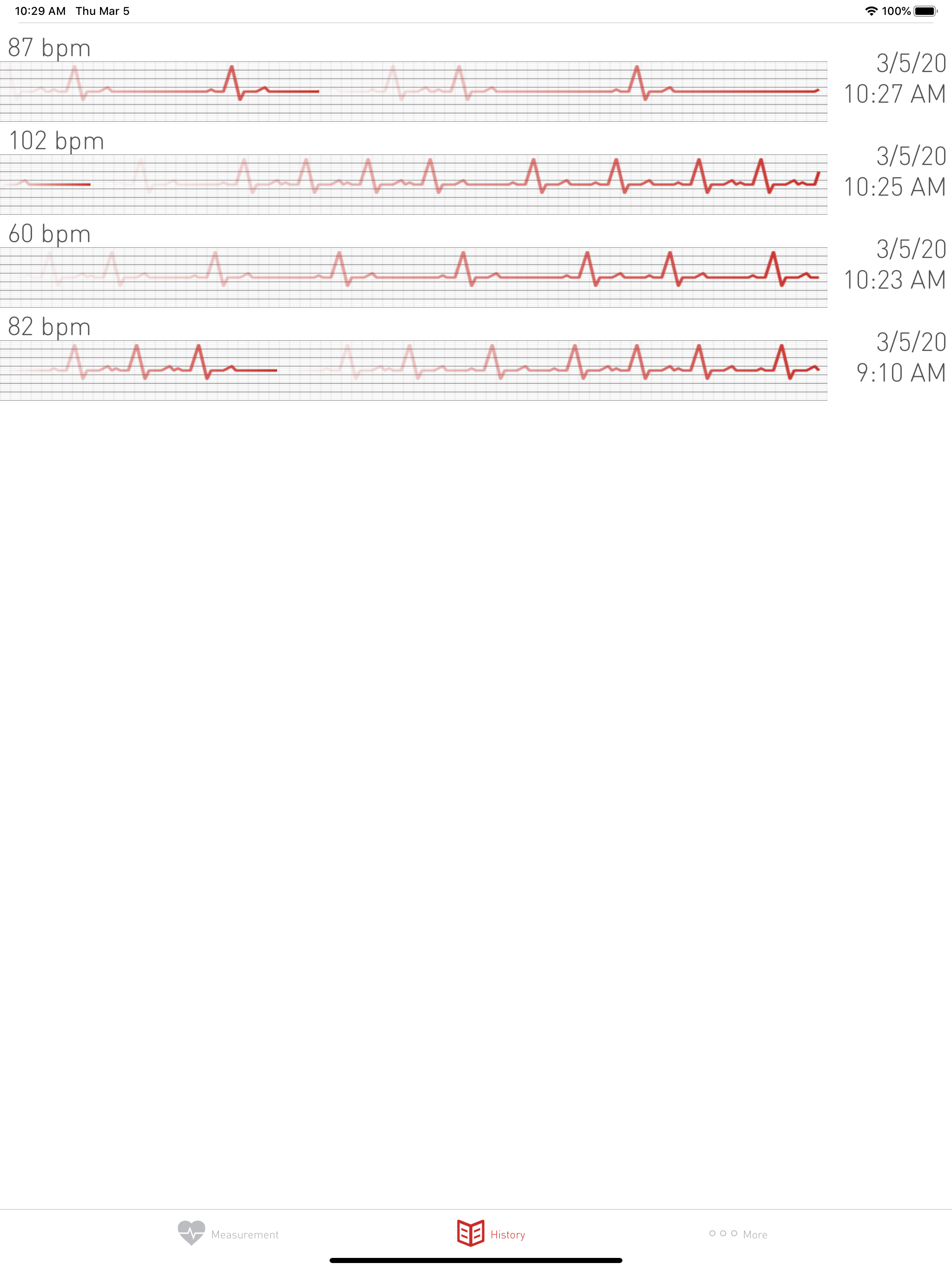 Cardiograph Heart Rate Monitor