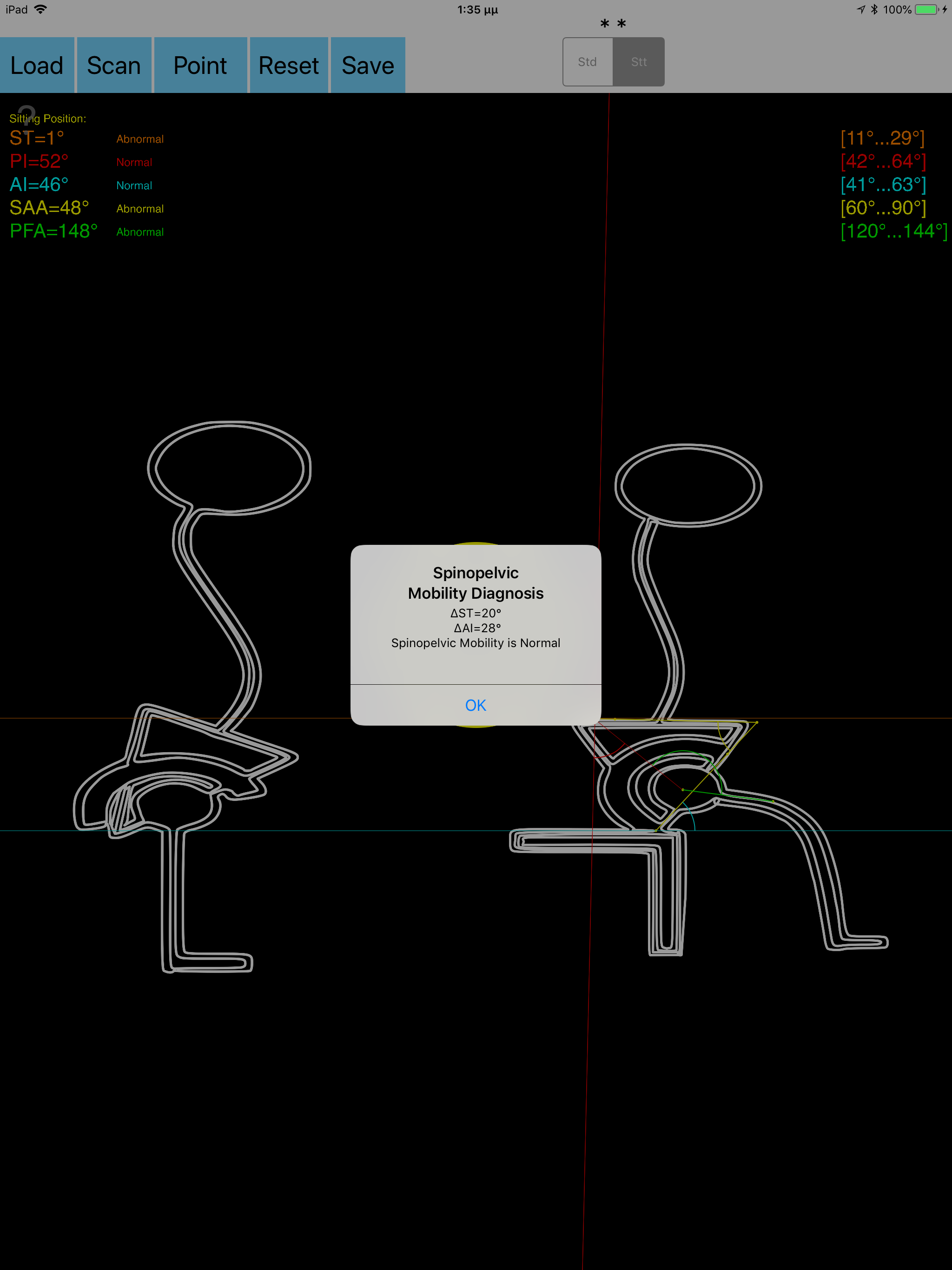 SpinopelvicMobilityApp screenshot 14