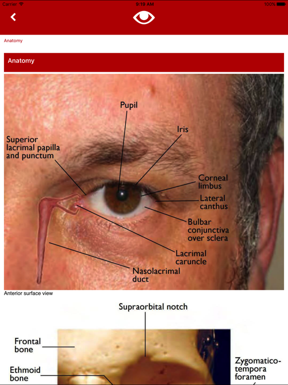 Eye Emergency Manualのおすすめ画像3