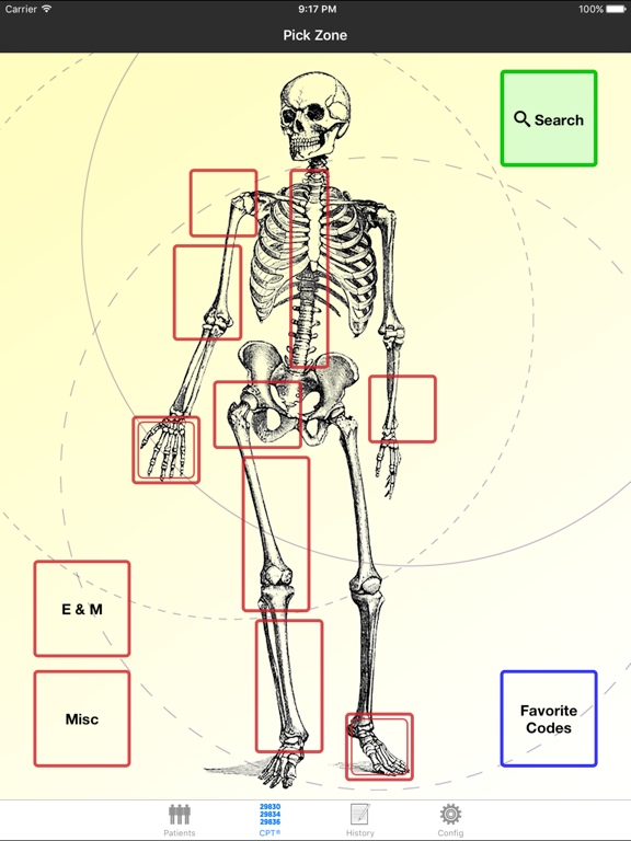 Mobile Coder Orthopedics iPad screenshot 1 - Medical app