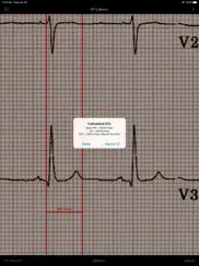 ep calipers ipad capturas de pantalla 4