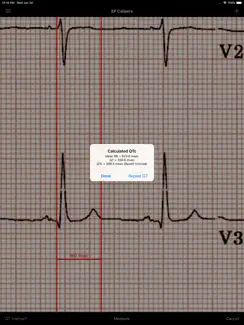 EP Calipers iPad image 4
