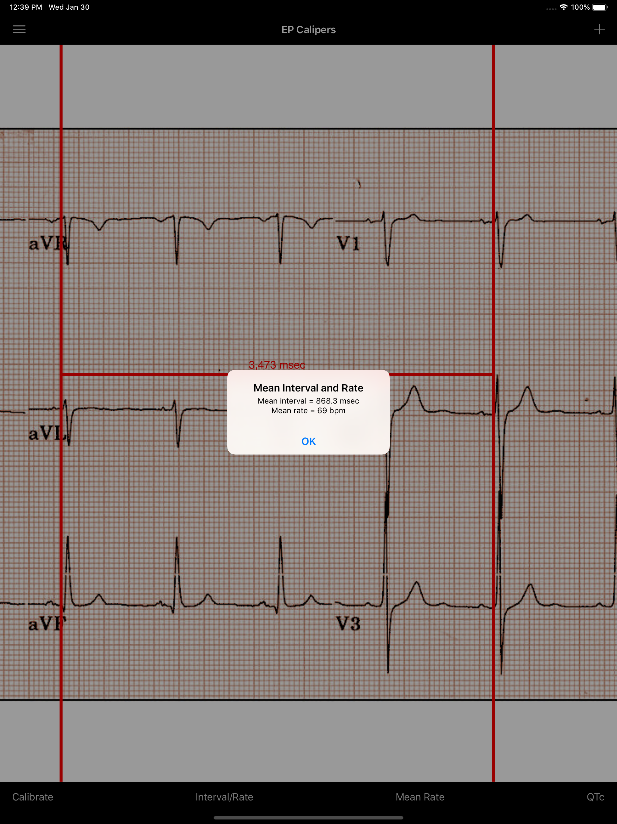 EP Calipers screenshot 14
