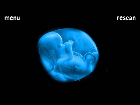 Screenshot #4 pour X-Ray Pregnant Woman Prank