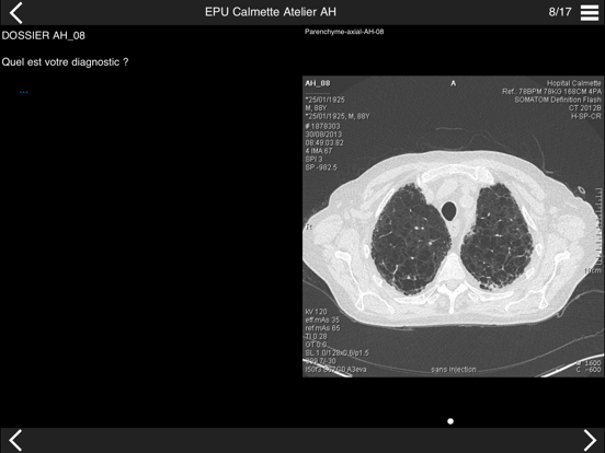 Screenshot #4 pour Cours TDM multicoupe du thorax