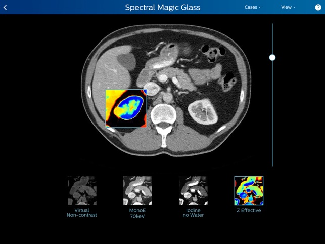 Philips IQon Spectral CT Fundamentals(圖3)-速報App