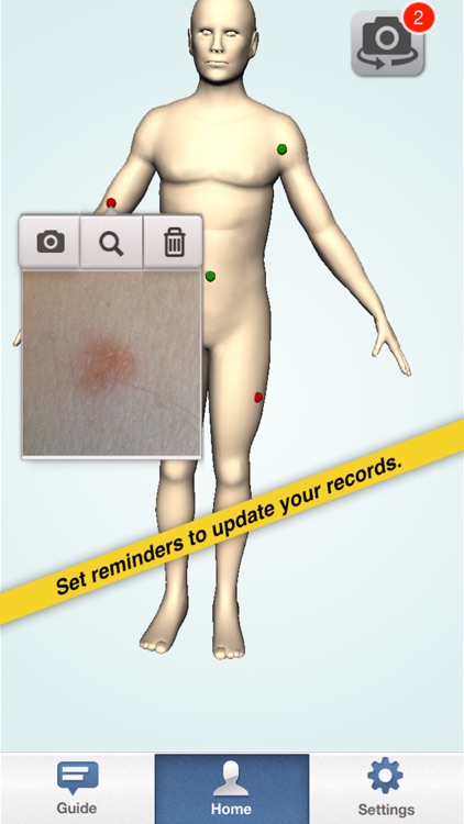 moleMonitor - Skin Cancer Mole Checker