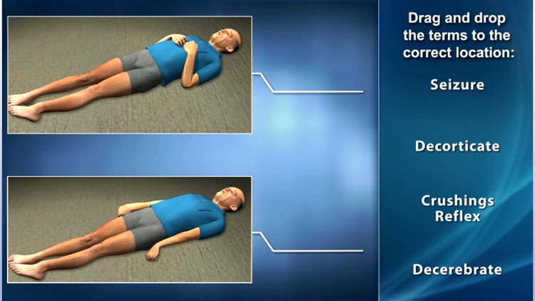 Medrills: Skull and Brain Injuries