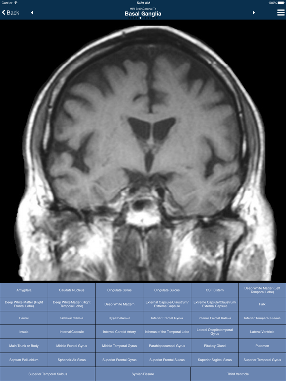 Screenshot #6 pour Nina Lite